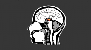 fmri-printzlau