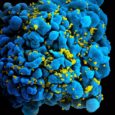 In a study of fifteen HIV-infected patients, a vaccine/drug therapy combo has enabled five participants to bring the virus under control with their own immune systems. […]