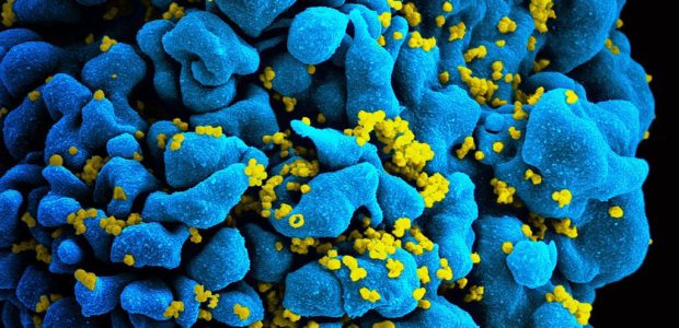 In a study of fifteen HIV-infected patients, a vaccine/drug therapy combo has enabled five participants to bring the virus under control with their own immune systems. […]